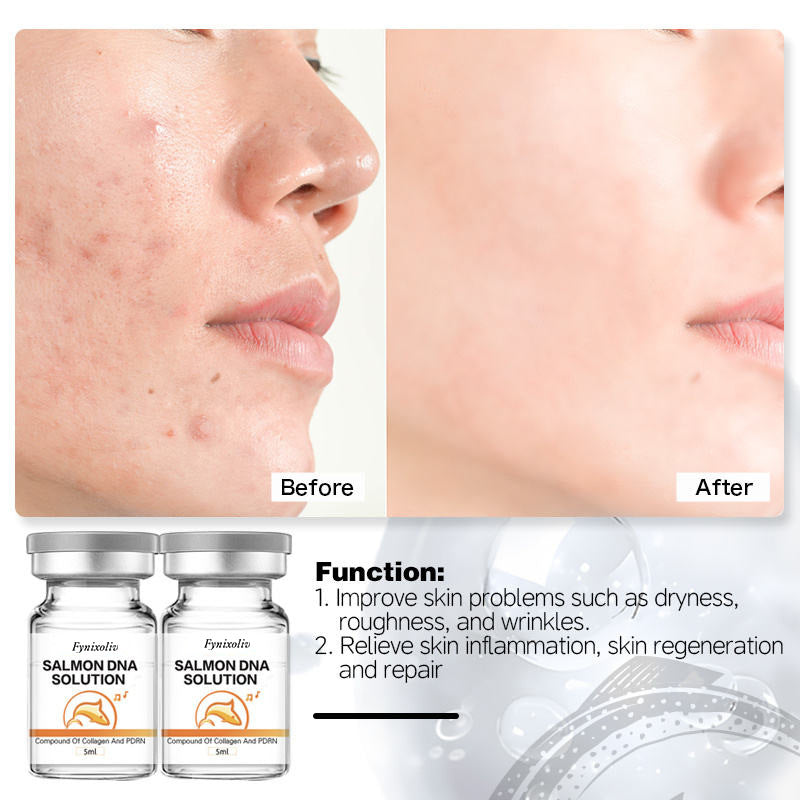 PDRN Salmon DNA + Hyaluronic Acid Serum – 5×5ml